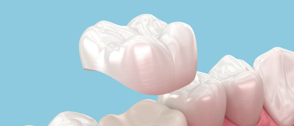 Ceramic Crown
